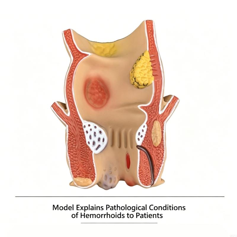 Q6PA 3D Pathologie-lesmodel, P - Medical Lab Observer recensie en prijs